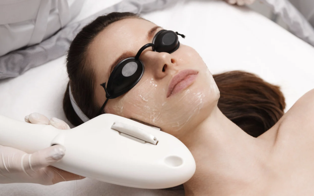 sun spot and age spot removal with lasers near Chevy Chase MD